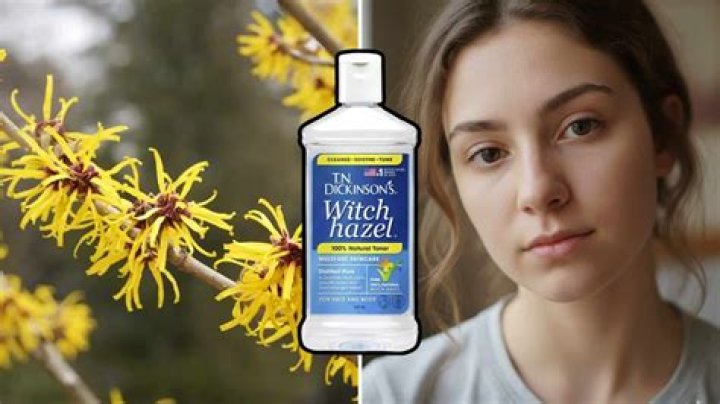 Does Witch Hazel Go Bad? Shelf Life, Storage Tips, and More