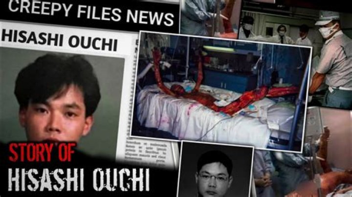 Hisashi Ouchi Photos Graphic: A Deep Dive into the Tragic Story