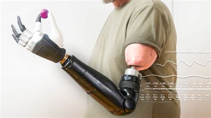 Revolutionizing Mobility: Exploring the Art and Science of Point Design Prosthetics