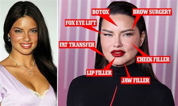 Understanding Adriana Lima's Journey with Body Image: The 