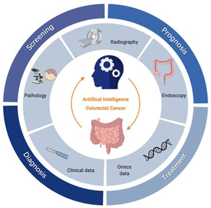 Understanding Pritchard Colon: Symptoms, Diagnosis, and Treatment